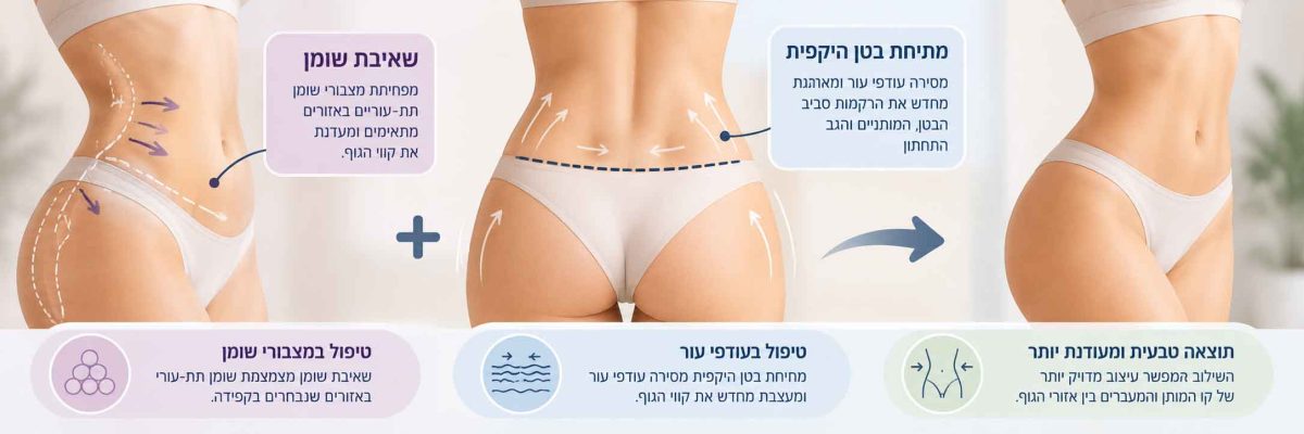איור רפואי המסביר שילוב של מתיחת בטן היקפית ושאיבת שומן, עם סימון אזורי הטיפול בעודפי עור ושומן בבטן ובמותניים והמחשת עיצוב קווי המתאר של הגוף.